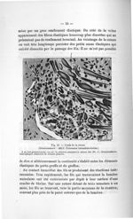 Fig. 10. Étude de la suture - Titres et travaux scientifiques
