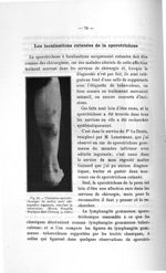 Fig. 39. Ulcération sporotrichosique du mollet, avec adénopathie inguinale, simulant la tuberculose  [...]