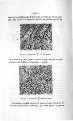 Fig. 68. Grossissement 140/1. Col. Van Gieson / Fig. 69. Grossissement 400/1. Hématéine-éosine - Tit [...]