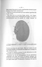 Fig. 74. Schéma de la tumeur - Titres et travaux scientifiques