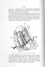 Fig. 50. Dissection de la lame cellulaire pleuro-vertébrale - Titres et travaux scientifiques