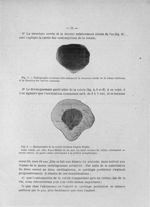 Fig. 3. Radiographie montrant très nettement la structure serrée de la trame rotulienne et la direct [...]