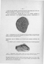 Fig. 5. Radiographie de la rotule d'une fillette de douze ans (Röpke) ; elle est entièrement ossifié [...]