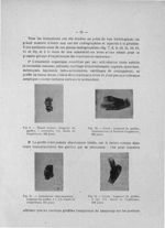 Fig. 9. Massif carpien : longueur du greffon, 1 centimètre 1/2. Durée de l'expérience, 228 jours / F [...]