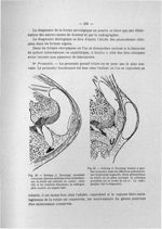 Fig. 55. Schéma (J. Ducuing) montrant comment, dans les arthrites et les hydarthroses, la rotule est [...]