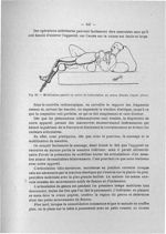 Fig. 62. Mobilisation passive ou active de l'articulation au genou (Dessin d'après photo) - Exposé d [...]