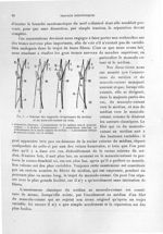 Fig. 5. Schéma des rapports réciproques du médian et du musculo-cutané au bras - Titres et travaux s [...]