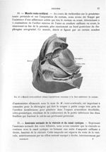 Fig. 10. Muscle recto-uréthral reliant l'aponévrose moyenne à la face antérieure du rectum - Titres  [...]