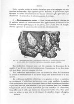 Fig. 40. Rétrécissement avec pachydermie rectale - Titres et travaux scientifiques