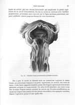 Fig. 49. Résultat d'une prostatectomie périnéale ancienne - Titres et travaux scientifiques