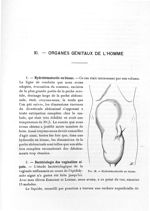 Fig. 52. Hydrohématocèle en bissac - Titres et travaux scientifiques