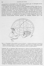 Fig. 1. Topographie crânio-cérébrale : scissure de Rolando - Archives de Doyen. Revue médico-chirurg [...]