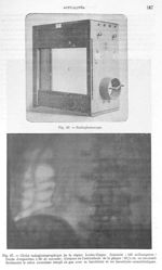 Fig. 26. Radiophotoscope / Fig. 27. Cliché radiophotographique de la région lombo-iliaque - Archives [...]
