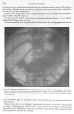 Fig. 28. Cliché radiophotographique de la région gastrique - Archives de Doyen. Revue médico-chirurg [...]