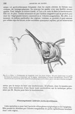 Fig. 8. Idem. Préhension de l'épiglotte avec une pince érigne - Archives de Doyen. Revue médico-chir [...]