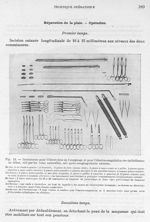 Fig. 12. Instruments pour l'électrolyse de l'oesophage et pour l'électro-coagulation des épithélioma [...]