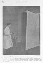 Fig. 16. Avale-fumée modèle Gervais-Courtellemont - Archives de Doyen. Revue médico-chirurgicale ill [...]