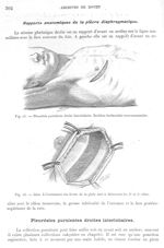 Fig. 15. Pleurésie purulente droite interlobaire / Fig. 16. Idem. L'écartement des lèvres de la plai [...]