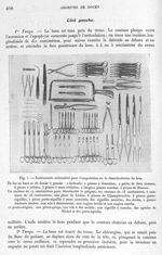 Fig. 1. Instruments nécessaires pour l'amputation ou la désarticulation du bras - Archives de Doyen. [...]