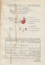 Légende du tableau iconographique des lésions - Archives de Doyen. Revue médico-chirurgicale illustr [...]