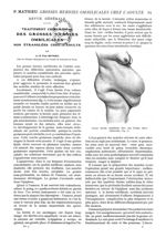 Fig. 1. - Grosse hernie ombilicale chez une femme obèse (Morestin) - Paris médical : la semaine du c [...]