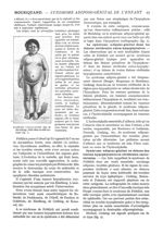 Fig. 1. - Syndrome adiposo-génital (cas de Madelung). Balle dans la selle turcique - Paris médical : [...]