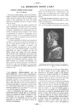Fig. 1. - Profil typique de nez en pied de marmite avec front olympien. Socrate du musée du Louvre,  [...]