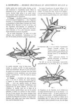 Fig. 3 Anesthésie et dissection du sac.- une aiguille courbe pénètre sous le pont séreux et le liqui [...]