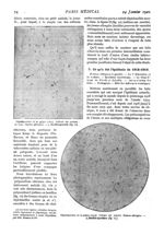 Fig. 11. - Diplobactéries de la grippe (1892) / Fig. 12. - Diplobactéries de la grippe (1914) - Pari [...]