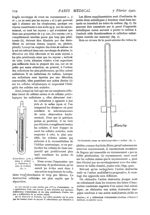 Fig. 1. - Etui-filtre pour tubes à radium / Fig. 2. - Hystéromètre creux en nickel pour tubes à radi [...]