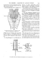 Fig. 6. - Le porte-radium placé dans le col / Fig. 7. - Porte-radium monté pour le traitement d'un n [...]