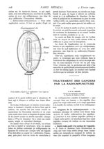 Fig. 10. - Porte-radium préparé pour applications intra-vaginales - Paris médical : la semaine du cl [...]