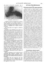 Fig. 2. - Radiographie sous plâtre - Paris médical : la semaine du clinicien
