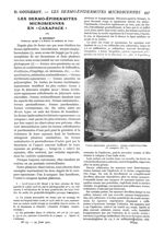 Fig. 1. - Dermo-épidermite microbienne strepto-staphylococcique en carapace - Paris médical : la sem [...]