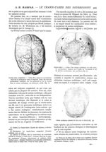 Fig. 1. - Cranio-tabes congénital - Crâne d'un enfant né au huitième mois de la grossesse et mort à  [...]