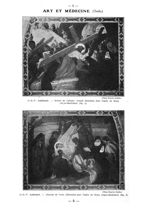 Fig. 5. - O.-D.-V. Guillonnet. - Montée du Calvaire. Grande décoration pour l'église du Brocq / Fig. [...]