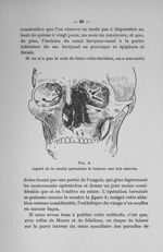 Bulletins et mémoires de la société française d'otologie, de laryngologie et de rhinologie