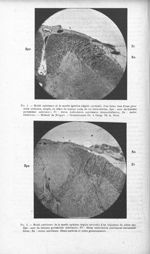 Fig. 1. Moitié antérieure de la moelle épinière (région cervicale) d'un foetus issu d'une grossesse  [...]