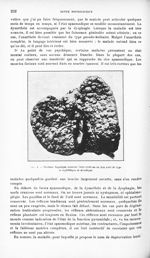 Fig. 3. Cirrhose hépatique avancée - Revue neurologique