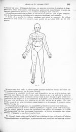 Fig. 1. [Sciatique radiculaire avec paralysie dissociée des muscles antéro-externes de la jambe droi [...]