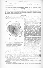 Fig. 1. Troubles de la sensibilité dans un zona de l'oreille par lésion du ganglion géniculé - Revue [...]