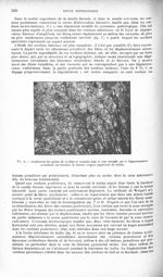 Fig. 9. Gonflement des gaines de myéline et vacuoles dans la zone occupée par la dégénérescence asce [...]