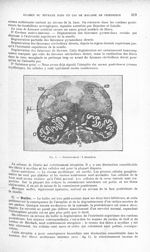 Fig. 1. Grossissement : 5 diamètres - Revue neurologique