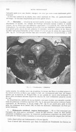 Fig. 4. Grossissement : 3 diamètres - Revue neurologique