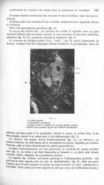 Fig. 2. a) Cellule granitée ; b) Gouttelettes sarcodiques ; c) Noyau ovoïde et régulier avec un gros [...]