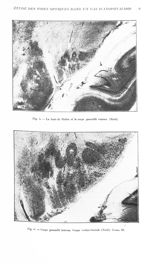 Fig. 5. La fente de Bichat et le corps genouillé externe. (Nissl) / Fig. 6. Corps genouillé interne. [...]