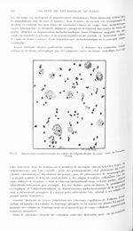Fig. 2. Dégénération métachromatique des cellules de l'oligodendroglie du centre ovale de Vieussens  [...]