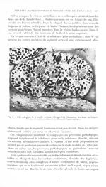 Fig. 6. Filet radiculaire de la moelle cervicale (Weigert-Pal). Diminution des fibres myéliniques. P [...]