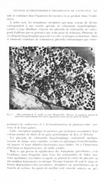 Fig. 7. Filet radiculaire de la moelle cervicale (Weigert-Pal). Observer les nombreux placards de sc [...]