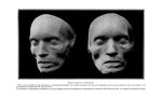 Masque mortuaire de Beethoven - La Chronique médicale : revue bi-mensuelle de médecine historique, l [...]